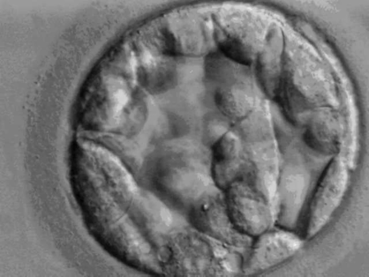 Light microscopy photograph of a human blastocyst at day 5